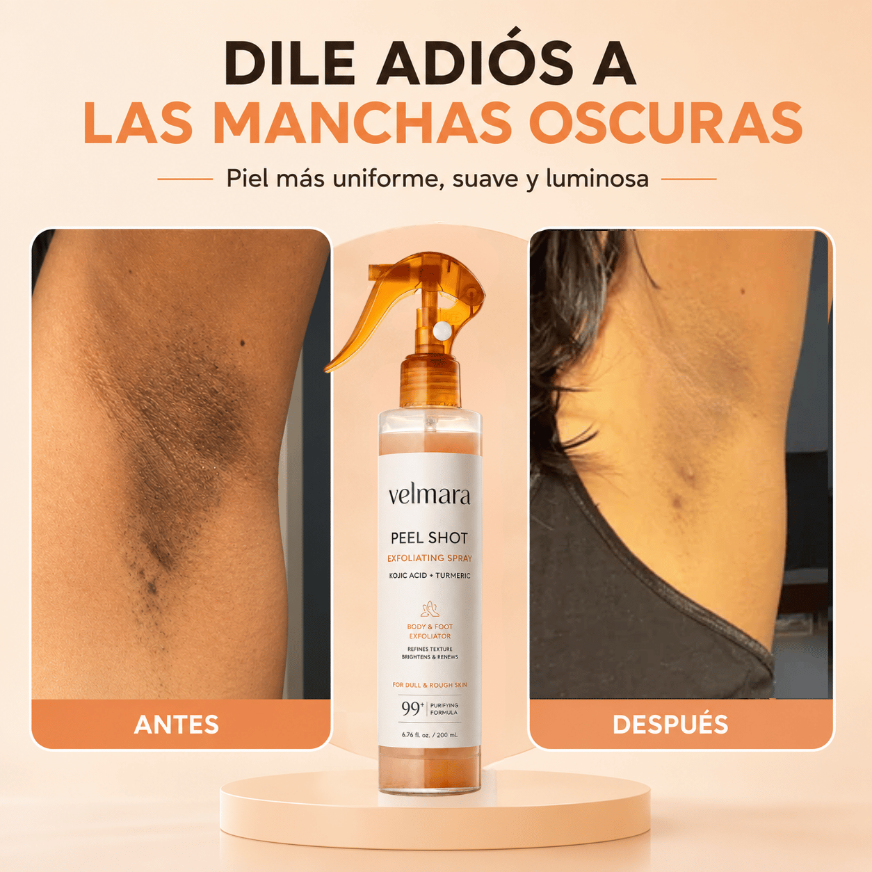 Velmara® | Spray exfoliante iluminador