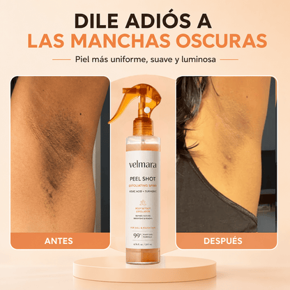 Velmara® | Spray exfoliante iluminador